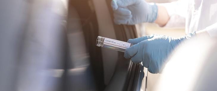 PUNKTY POBRAŃ WYMAZÓW NA OBECNOŚĆ KORONAWIRUSA W POWIECIE OSTRÓDZKIM I WOJEWÓDZTWIE 13 729x308 11